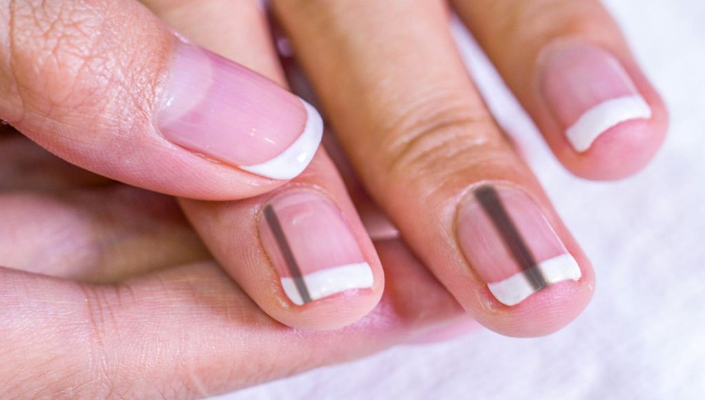 how-to-get-rid-of-black-lines-on-nails-health-for-best-life